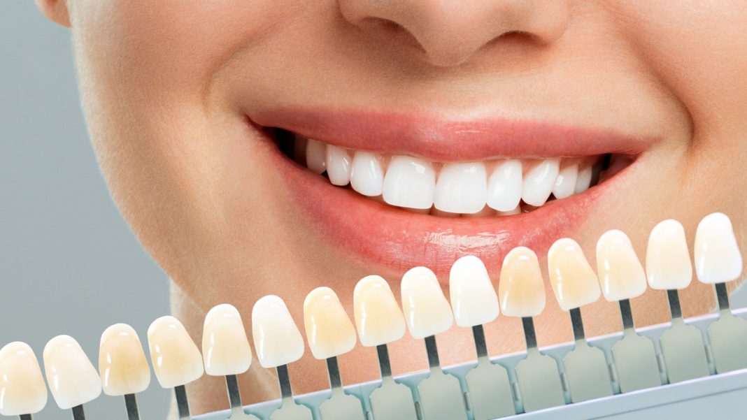 Pasta z diamentowym pyłem usuwa 100 proc. przebarwień. To polerka, która wybiela o kilka odcieni