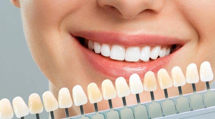 Pasta z diamentowym pyłem usuwa 100 proc. przebarwień. To polerka, która wybiela o kilka odcieni