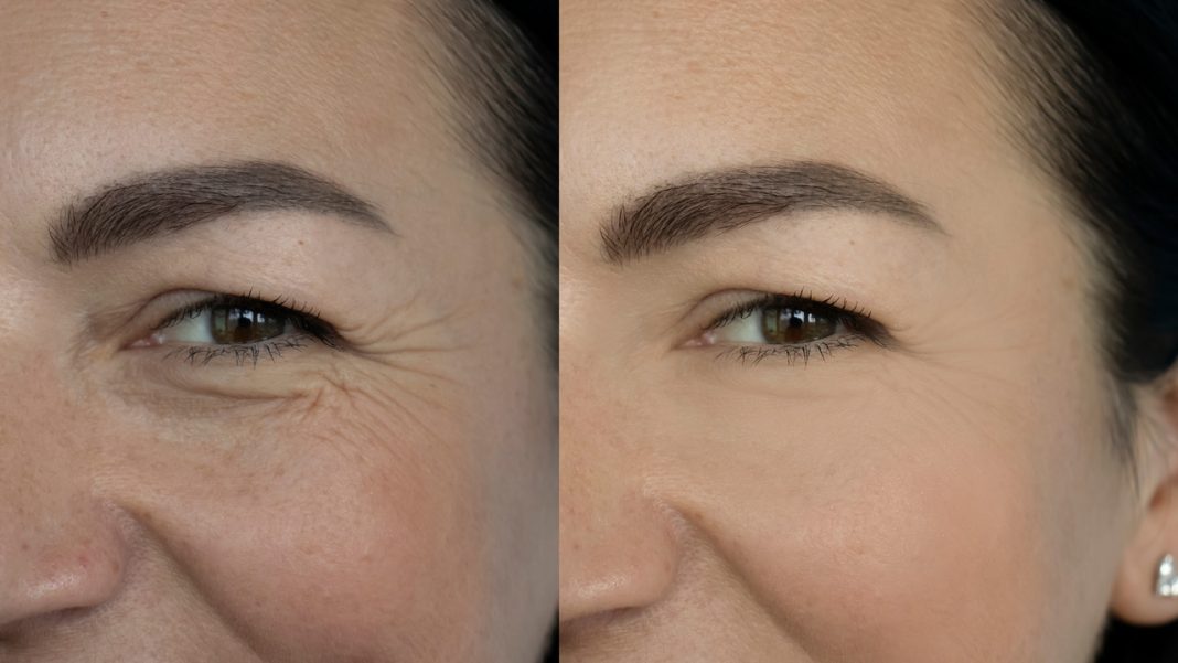 Ten krem działa jak liftingujące nici. Unosi kontur oczu, koryguje zmarszczki. Daje szybkie efekty