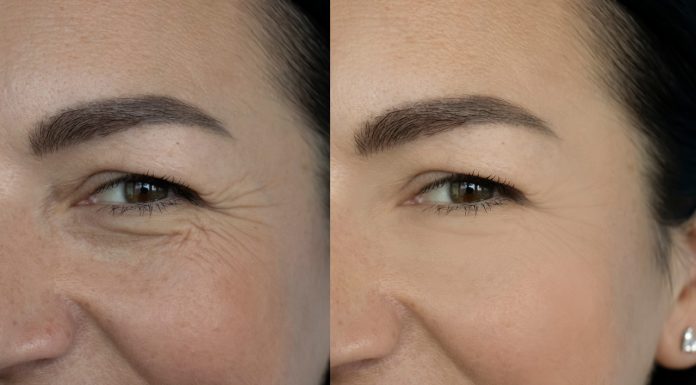 Ten krem działa jak liftingujące nici. Unosi kontur oczu, koryguje zmarszczki. Daje szybkie efekty