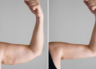 Ten modelujący koncentrat ujędrni obwisłą skórę na ramionach i rozprawi się z „pelikanami”. Jest mocny