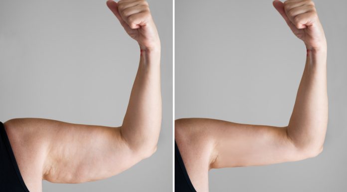 Ten modelujący koncentrat ujędrni obwisłą skórę na ramionach i rozprawi się z „pelikanami”. Jest mocny