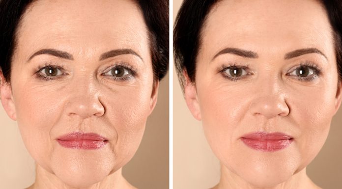 Zamiast liftingu: te kremy fenomenalnie poprawiają owal twarzy. Zapomnij o opadających policzkach