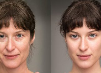 Ten hialuronowy wypełniacz ekspresowo „prasuje” zmarszczki. To wygładzający pewniak!