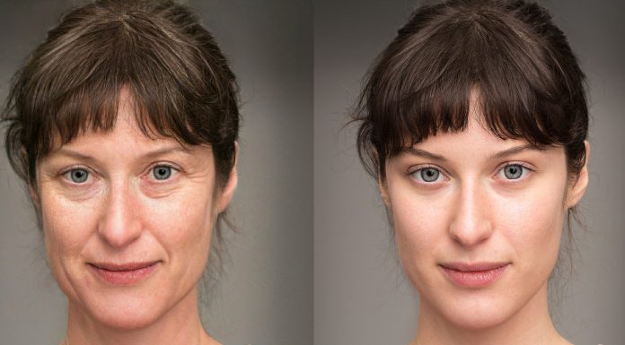 Ten hialuronowy wypełniacz ekspresowo „prasuje” zmarszczki. To wygładzający pewniak!