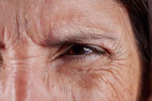 Zalej wodą i nałóż na twarz. Królicze zmarszczki znikną w mig