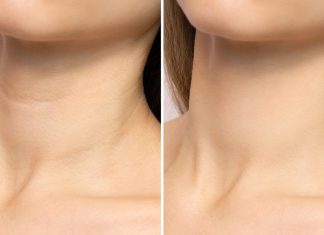 Odbudowuje utraconą gęstość skóry, szybko odmłodzi szyję. Z nim pozbędziesz się „obręczy Wenus”