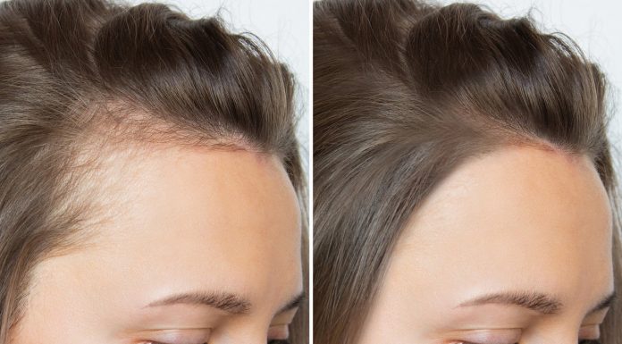 Szybkie i skuteczne odżywki — stymulują mieszki, poprawiają gęstość włosów