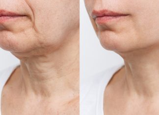 Zmarszczki będą bez szans. Ten domowy sposób nie ma sobie równych