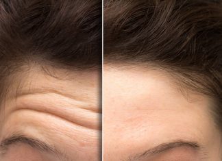 Ten krem działa jak wygładzający plaster na zmarszczki na czole. To niedrogi wypełniacz z drogerii