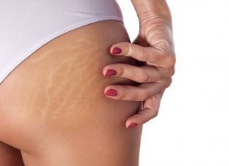 Olejek z witaminą E zwiększa odporność skóry na rozciąganie. Zapobiega powstawaniu rozstępów