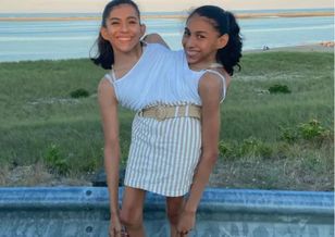 Wciąż słyszą te same pytania. Bliźniaczki syjamskie odpowiedziały