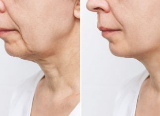 Mocny krem zagęszczający skórę na wiotki i galaretowaty podbródek. „Zawsze kupuję go na zapas”