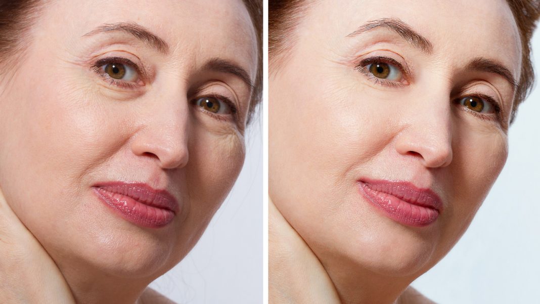 Ten hialuronowy koktajl