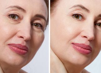 Ten hialuronowy koktajl „wypycha” skórę ku górze. To najlepszy wypełniacz zmarszczek