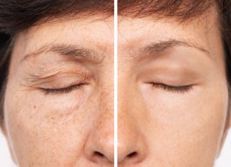 Ten polski krem „wymazuje” zmarszczki z powiek! Hit za mniej niż 10 zł