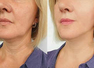 Trzy dobre i niedrogie sera liftingujące do codziennego stosowania. Tajna broń w pielęgnacji anti-age!