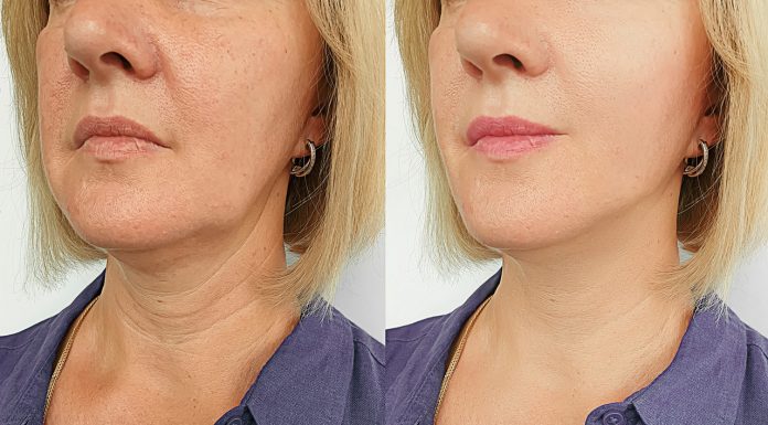 Trzy dobre i niedrogie sera liftingujące do codziennego stosowania. Tajna broń w pielęgnacji anti-age!