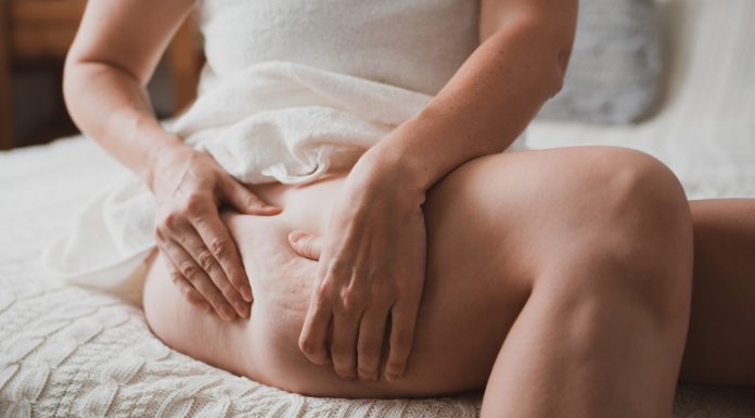 Cztery dobre masażery antycellulitowe. Kosztują mniej niż seria zabiegów w gabinecie kosmetycznym
