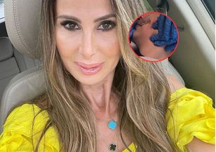 Mężczyźni w gabinetach medycyny estetycznej. Co poprawiają?