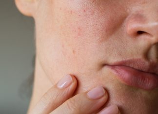 Trzy świetne kosmetyki zwężające pory. Działają jak wygładzający filtr