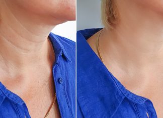 Ten kolagen w kremie sprawia, że dekolt staje się gładki jak tafla lustra. Usuwa też postarzające obręcze Wenus z szyi