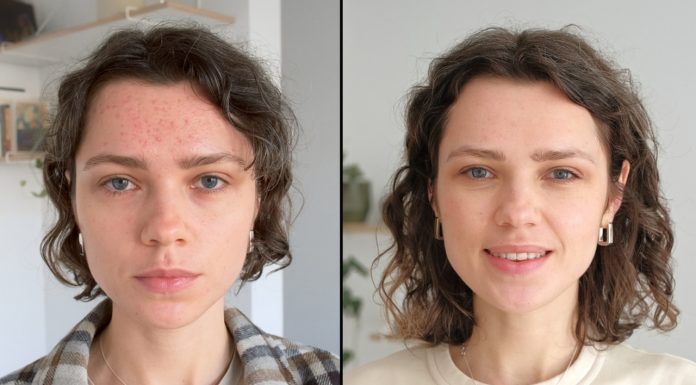 Oczyszcza pory 10 razy lepiej niż topowe peelingi. Cera staje się jedwabista