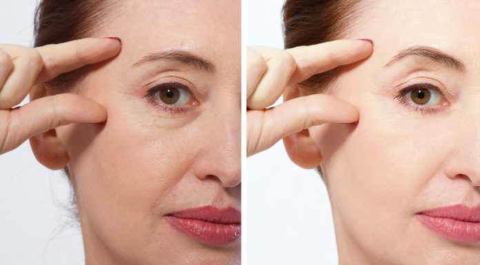 Jest naszpikowany peptydami i w 10 dni wygładza kontur oczu. Polecają go beauty ekspertki