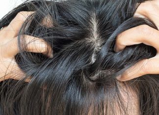 Dlaczego skóra głowy swędzi? Poznaj główne przyczyny