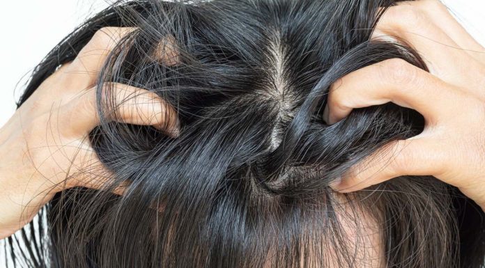 Dlaczego skóra głowy swędzi? Poznaj główne przyczyny