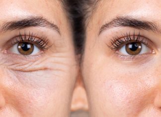 To najlepszy „napinacz” skóry na okolice oczu. Zmniejsza zmarszczki już po godzinie od użycia