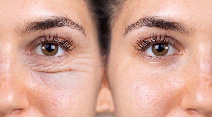 To najlepszy „napinacz” skóry na okolice oczu. Zmniejsza zmarszczki już po godzinie od użycia