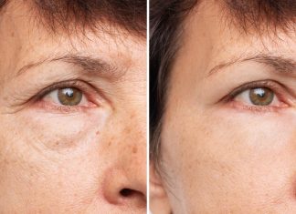 Żaden krem pod oczy nie da takiego efektu. Ten masażer redukuje obrzęki