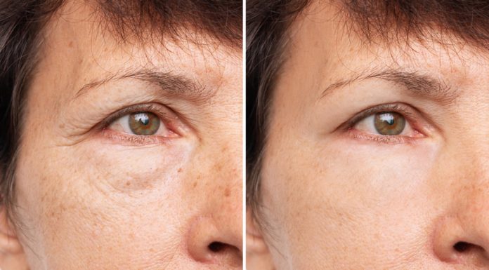 Żaden krem pod oczy nie da takiego efektu. Ten masażer redukuje obrzęki