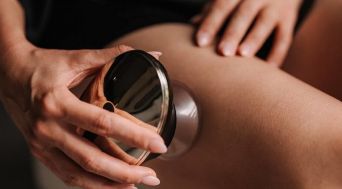 Zapomnij o bańce chińskiej. To urządzenie wynosi masaż podciśnieniowy na wyższy poziom — jest świetne na cellulit