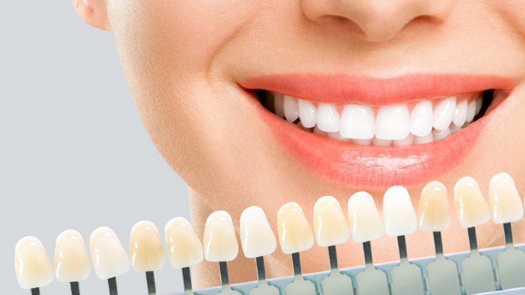 Ten optyczny rozjaśniacz zębów działa już po pierwszym użyciu. Wybiela do trzech odcieni