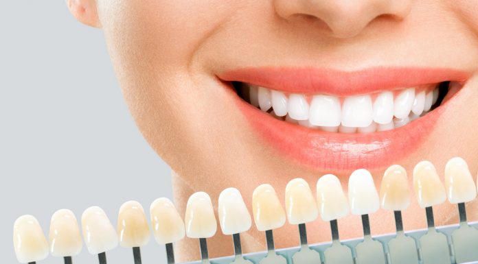 Ten optyczny rozjaśniacz zębów działa już po pierwszym użyciu. Wybiela do trzech odcieni