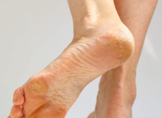 Naturalny wygładzacz do stóp. Pomoże nawet przy głębokich pęknięciach