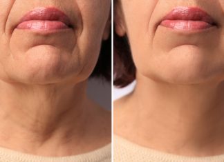 Te kolagenowe shoty pompują skórę jak wypełniający zastrzyk. „Żaden krem nie wygładził tak mojej cery”