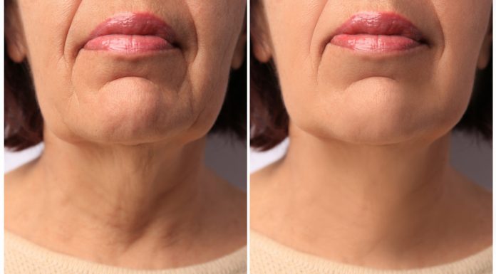 Te kolagenowe shoty pompują skórę jak wypełniający zastrzyk. „Żaden krem nie wygładził tak mojej cery”