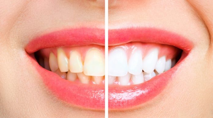 Ta pasta dla kawoszy rozjaśnia już w pięć dni i to o kilka odcieni. „Żałuję, że kupiłam ją dopiero teraz”