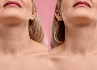 To złoto na obwisłą skórę i postarzające „obręcze Wenus” u 70-latek. „Polecam teraz każdej koleżance”