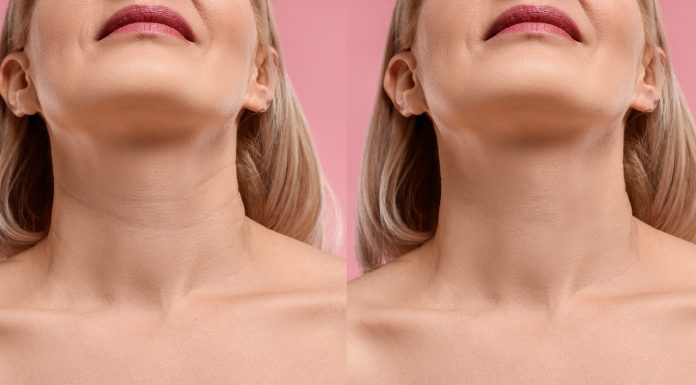 To złoto na obwisłą skórę i postarzające „obręcze Wenus” u 70-latek. „Polecam teraz każdej koleżance”