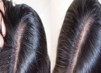 W mig rozprawi się z łupieżem, usunie z włosów nadmiar sebum. Ten szampon sprawdzi się do wszystkich typów włosów