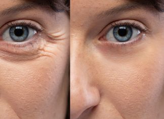 Pięć kremów, które spektakularnie wypełniają zmarszczki pod oczami. Odmłodzą spojrzenie
