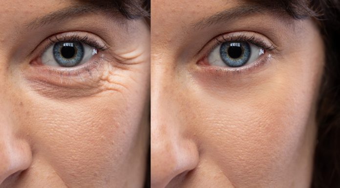 Pięć kremów, które spektakularnie wypełniają zmarszczki pod oczami. Odmłodzą spojrzenie