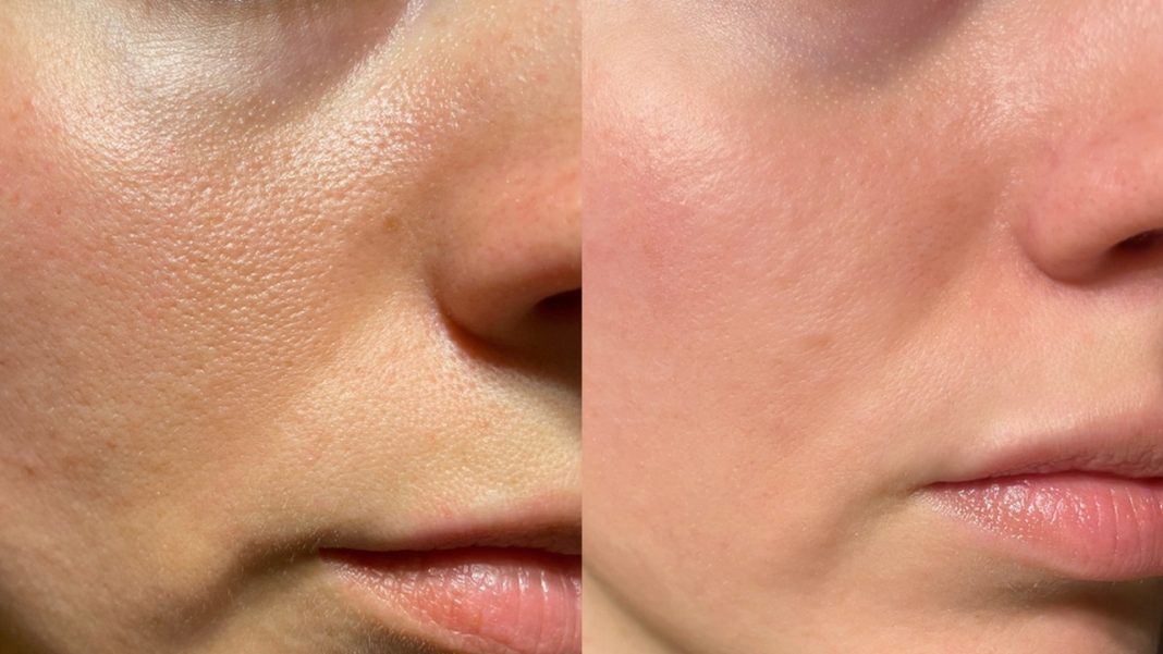 To serum wymazuje zmęczenie z twarzy!