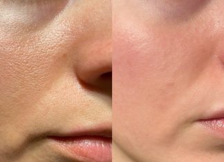 To serum wymazuje zmęczenie z twarzy! „Nawet mój partner go używa”