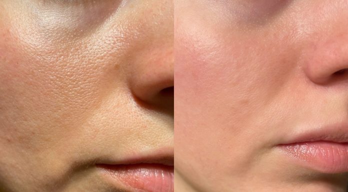 To serum wymazuje zmęczenie z twarzy! „Nawet mój partner go używa”