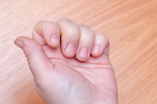 Popatrz na paznokcie. Siedem alarmujących sygnałów